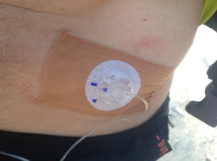 Canula sweating off and dooming you to coma and/or failure? This was a trade-off that worked well, some chafed skin in return for lifegiving insulin goodness for the rest of the event (and what an event it was).